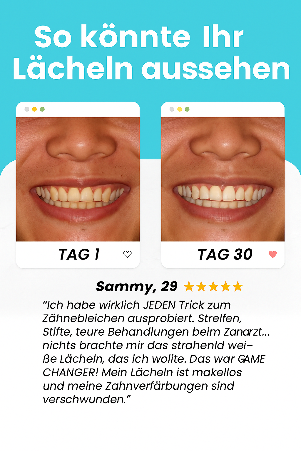 SHINLY® – Vollautomatische U-förmige Zahnbürste