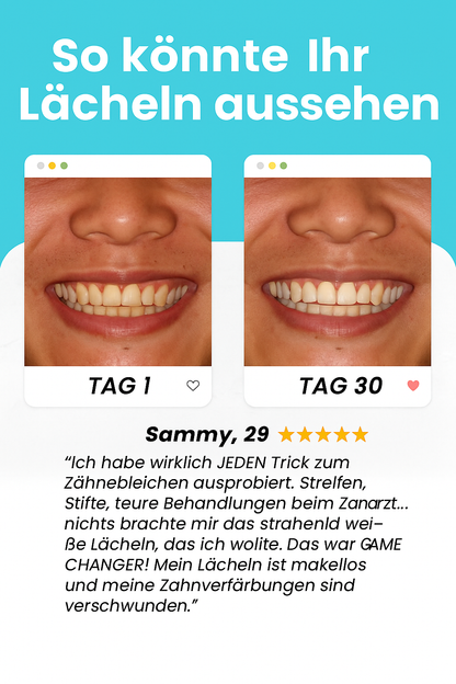 SHINLY® – Vollautomatische U-förmige Zahnbürste